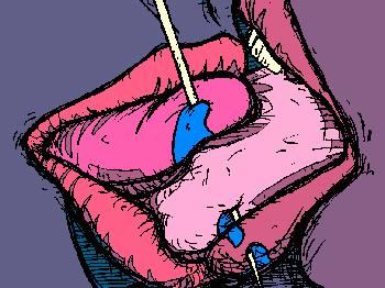 pink